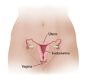 Corte transversal frontal de útero y vagina en donde se ve el recubrimiento del endometrio dentro del útero.